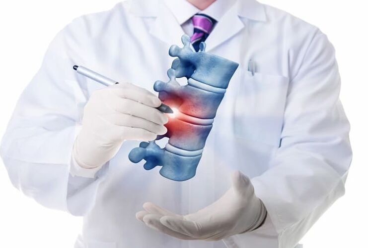 Lesiones espinales debido a osteocondrosis torácica.